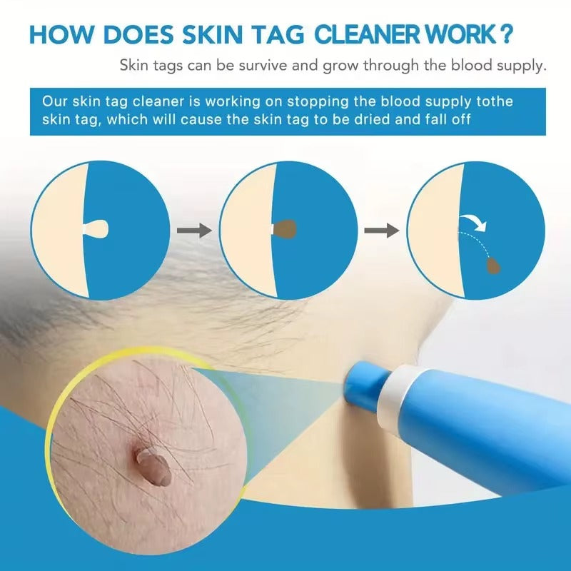 SilkTag™ Safe and Gentle Tag Remover