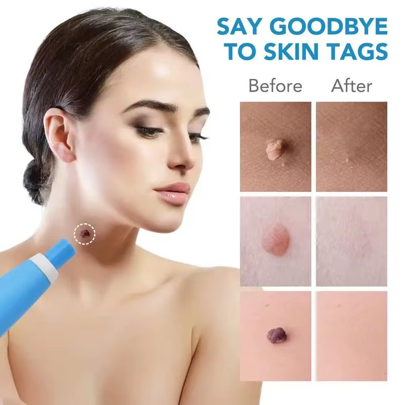 SilkTag™ Safe and Gentle Tag Remover